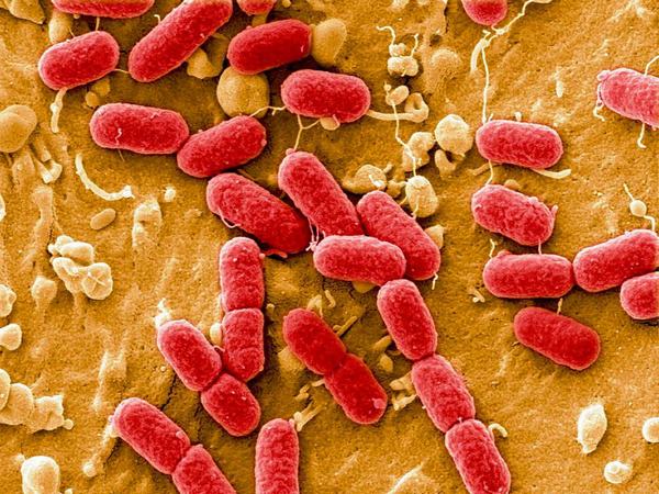 Кишечная палочка в 80% случаев является причиной бактериального простатита