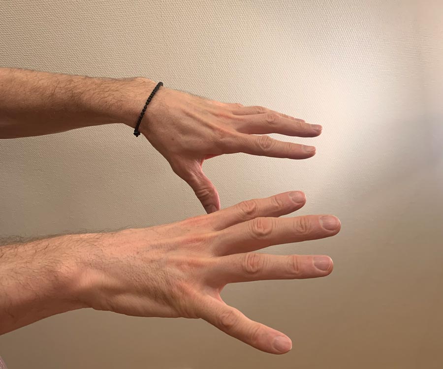 Физические упражнения при артрите пальцев рук