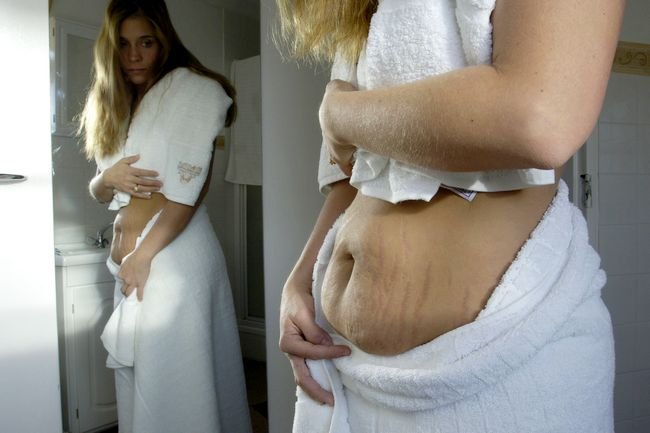 Как убрать живот после родов