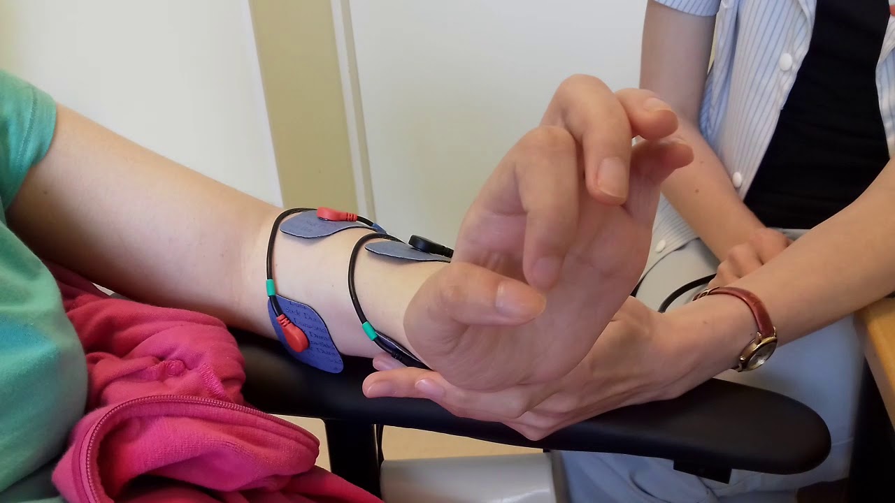 Упражнения для руки после инсульта